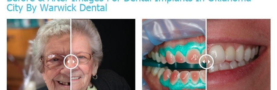 Warwick Dental Oklahoma City | Dental Implants & Dentures Cover Image